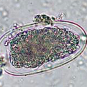 Oesophagostomum spp. egg