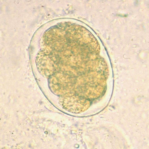 Oesophagostomum spp. egg
