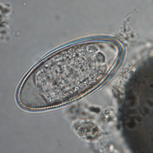 Pinworm eggs