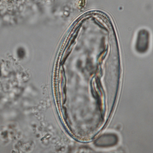 Pinworm eggs