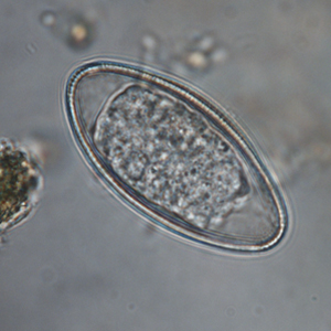 Pinworm eggs