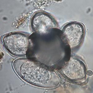 Pinworm eggs agglutinated around a bubble
