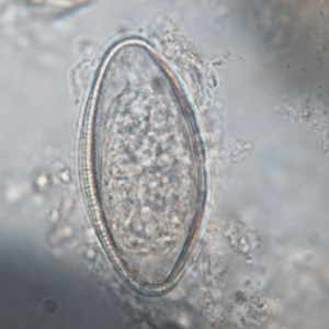 Pinworm eggs