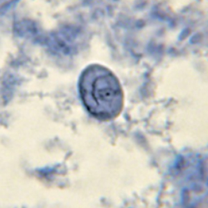 Retortamonas intestinalis cysts stained with iron hematoxylin