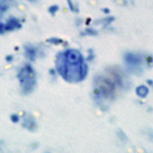 Retortamonas intestinalis cysts stained with trichrome