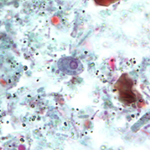 Retortamonas intestinalis cysts stained with trichrome