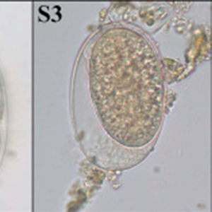Strongyle eggs found in non-human primates (Klaus et al., 2017)