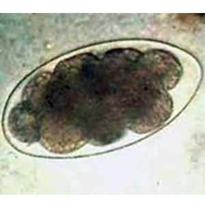 Trichostrongyloidea egg