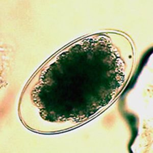 Trichostrongyloidea egg