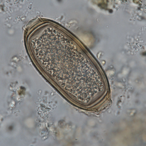 Whipworm egg