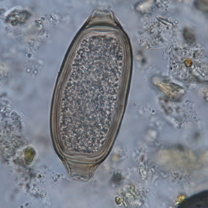 Whipworm egg
