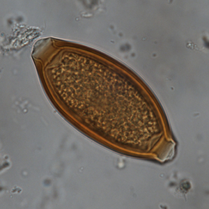 Whipworm egg