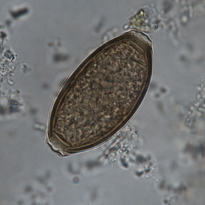 Whipworm egg