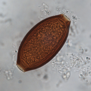 Whipworm egg