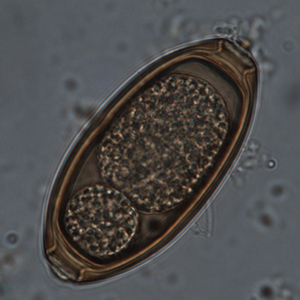 Whipworm egg