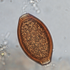 Whipworm egg