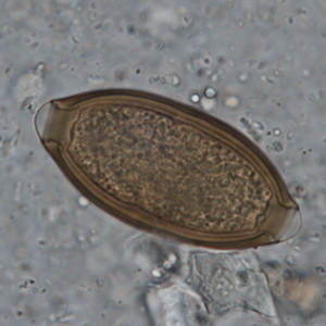 Whipworm egg