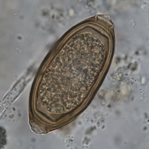 Whipworm egg